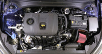 AEM Induction C.A.S. 19-20 Kia Forte 2.0L F/I Cold Air Intake System
